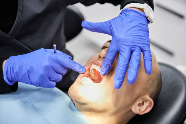 Best Emergency Root Canal Treatment in Seabrook, SC