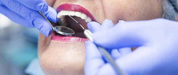 Best Emergency Dentist for Lost Fillings or Crowns in Seabrook, SC