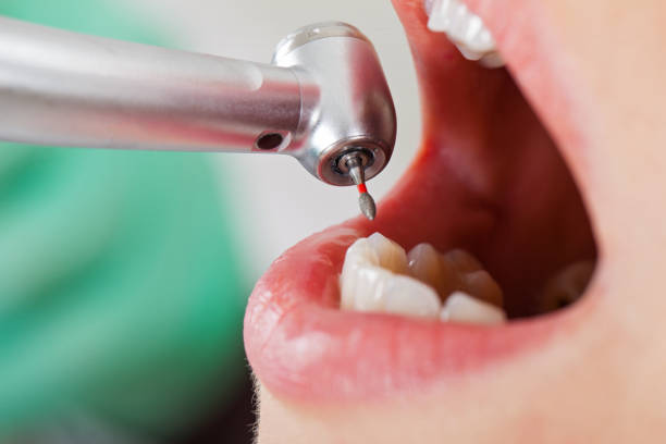 Best Weekend Emergency Dentist in Seabrook, SC
